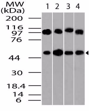 Western blot analysis of Beta Tubulin. Anti- Beta Tubulin antibody (2) Hela, 3) MCF7 and 4) 3T3 lysates.
